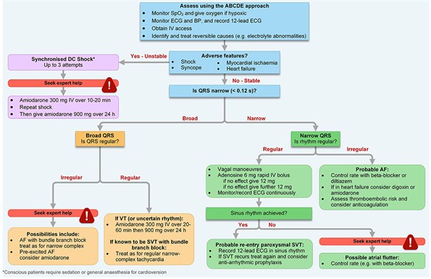 G2015 Adult tachycardia algorithm